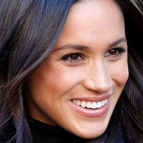 Has Meghan Markle Sparked A Trend For More Natural Cosmetic Procedures ...