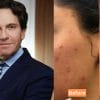 Dr. Dennis Gross Perfect Skin Routine