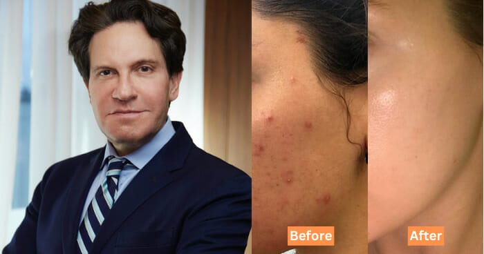 Dr. Dennis Gross Perfect Skin Routine